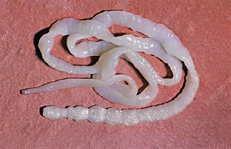  Gregarina: The Tiny Tapeworm That Makes Your Gut Squirm!