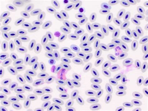  Leucocytozoon! A Microscopic Marvel That Makes Birds Shake and Tremble