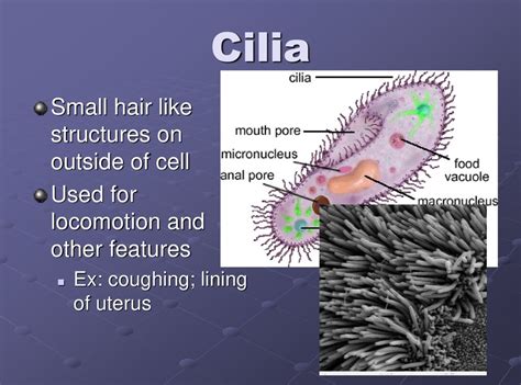  Onychodromus! This Ciliate Swims Gracefully With Thousands of Tiny Hair-Like Structures