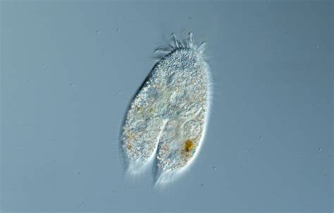  Oxytricha!  A Ciliate So Tiny It Could Dance on Your Fingernail