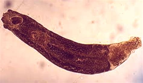  Xiphidiocercariae: A Tiny Trematode That Can Transform its Host!